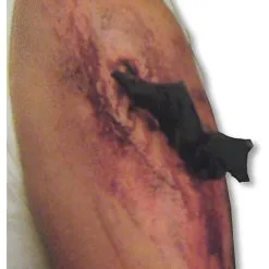 Große Metall Attacke Wunde