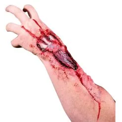 Weggefressener Unterarm Latexwunde